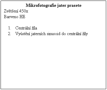 Textov pole: Mikrofotografie jater prasete
Zvten 450x 
Barveno HE
 
Centrln la
Vystn jaternch sinusoid do centrln ly
 
 
 
