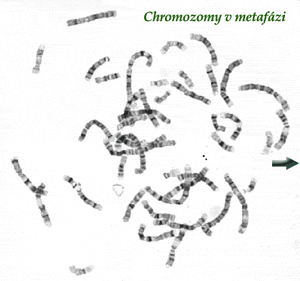 http://www.waisman.wisc.edu/cytogenetics/CaseConference/CConf00Bmeta.html